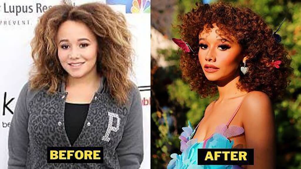 Talia Jackson Before and After