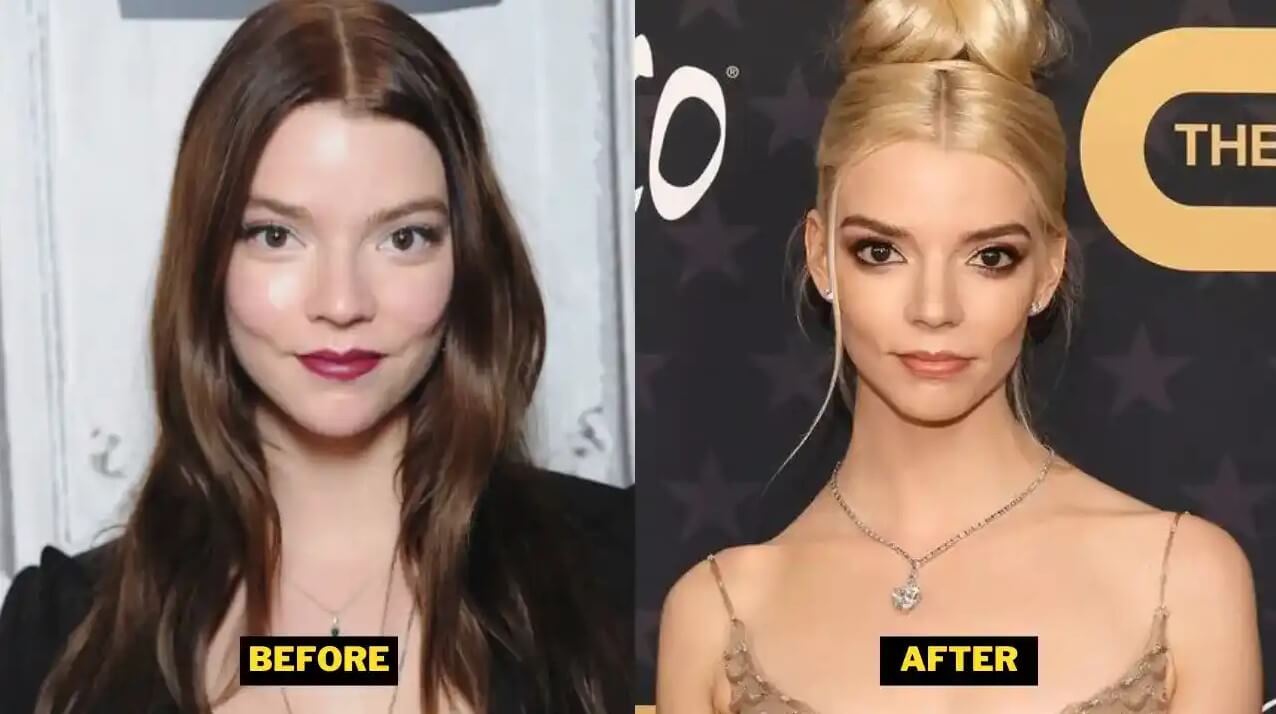 Anya Taylor-Joy Before and After