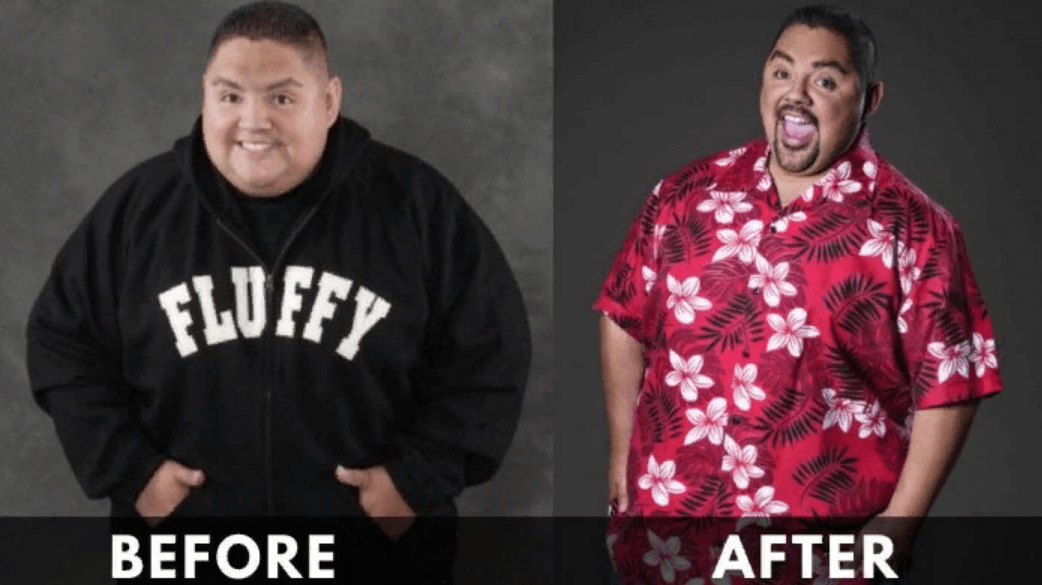 Gabriel Iglesias Before and After
